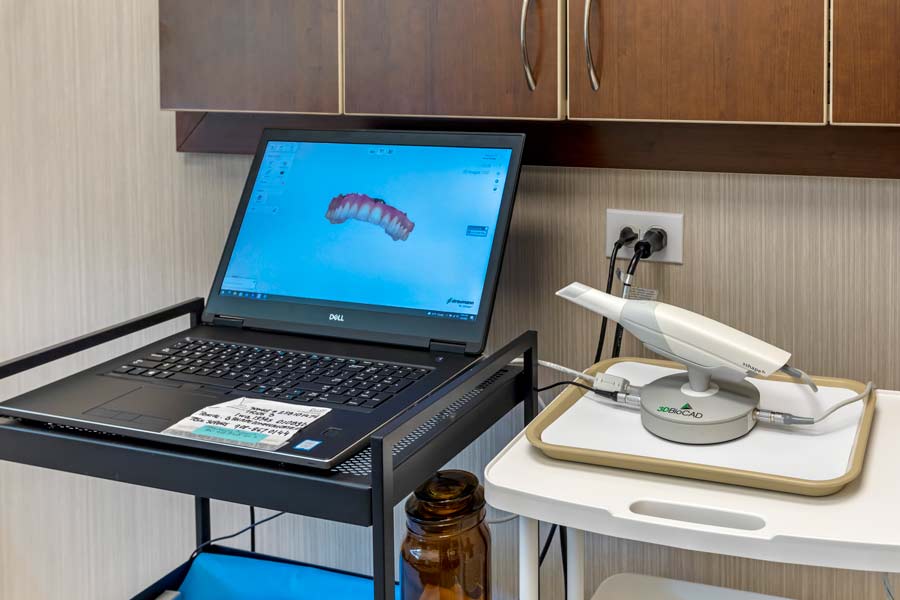 Oral scanner digital impression at Glen Perio in Glenview, IL 