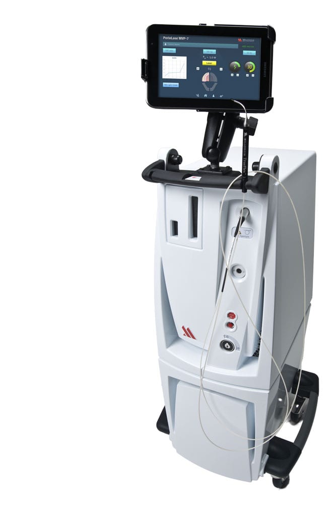 LANAP PerioLase machine