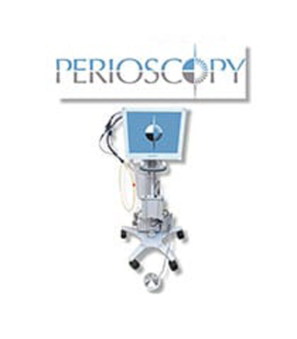 Perioscopy technology