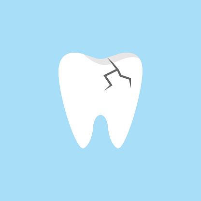 Cracked tooth graphic.