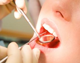 Image of a gum disease screening, at Glen Perio in Glenview, IL.