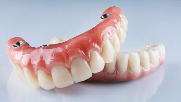 Close-up of a full-arch All-on-4 dental implant set, showcasing artificial teeth secured with implants.